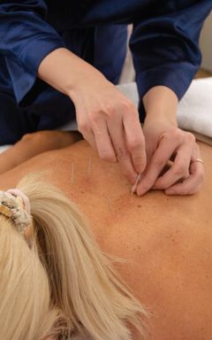 Community Acupuncture Session cover