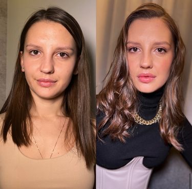 3 image in gallery